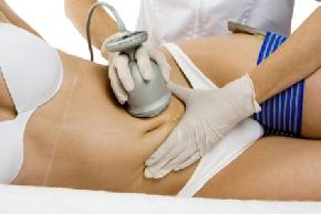Cavitacion o Liposuccion sin Cirugia Cavitacion o Liposuccion sin Cirugia