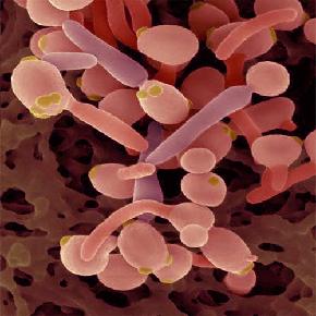 Candida Candida