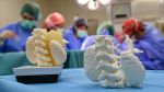 El Hospital Sant Joan de Déu utiliza una impresión en 3D de un tumor