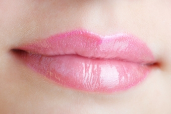 El Lifting de labios, última tendencia en rejuvenecimiento facial en España