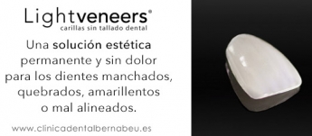 Carillas dentales, solución indolora para rejuvenecer toda una sonrisa