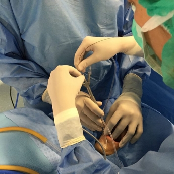Policlínica Gipuzkoa, primer centro sanitario privado del País Vasco en aplicar la técnica de la sialoendoscopia 