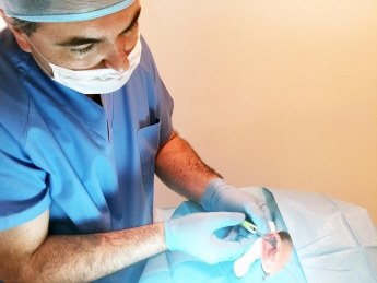 El Dr. Agustín Valverde realiza en Alicante las tres primeras otoplastias sin cirugía de España