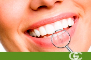 Consejos para hacer más llevadero el postoperatorio de implantes dentales