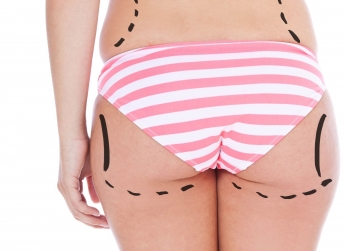 10 cosas que hay que saber sobre la liposucción