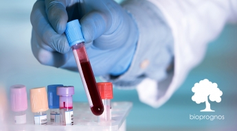 Bioprognos anuncia nueva versión de OncoCUP Dx, que ahora identifica hasta 30 tipos diferentes de cáncer