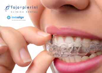 La Clínica Dental Fojo y Pierini desvela las principales ventajas del sistema de ortodoncia Invisalign