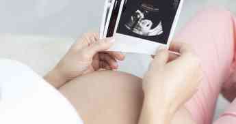 Entre el 50 y el 70% de los embriones humanos tienen una anomalía cromosómica que  provoca infertilidad y abortos espontáneos