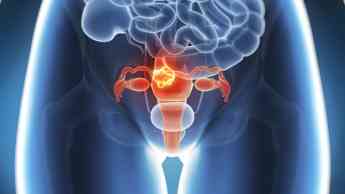 La mayoría de los casos de cáncer de útero en mujeres jóvenes se detectan durante los tratamientos de infertilidad