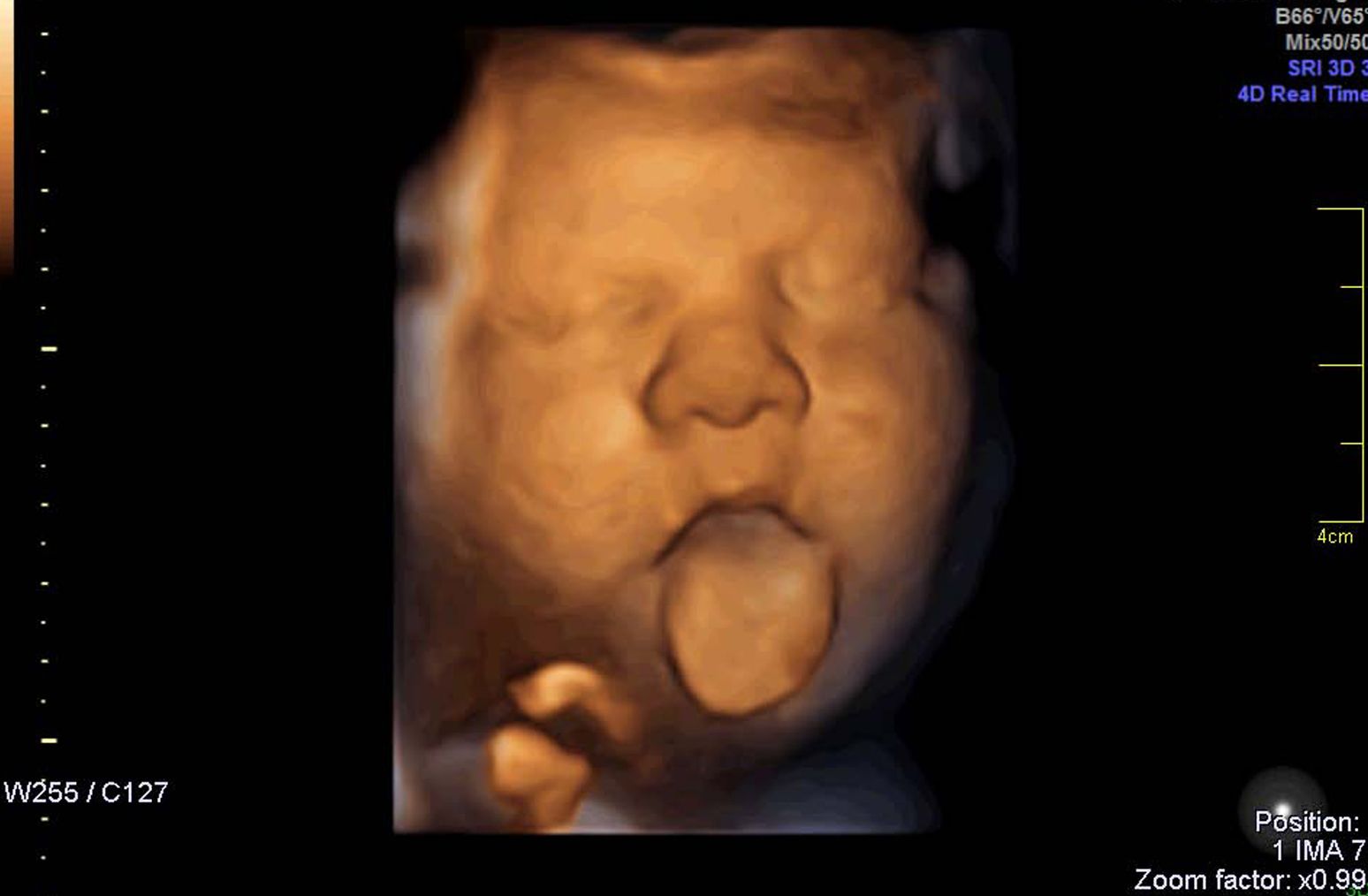 Fotografia Respuesta fetal