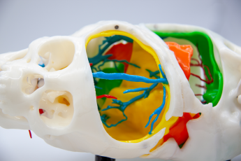 Tecnología 3D española de Cella ayuda a separar con éxito a dos gemelas egipcias