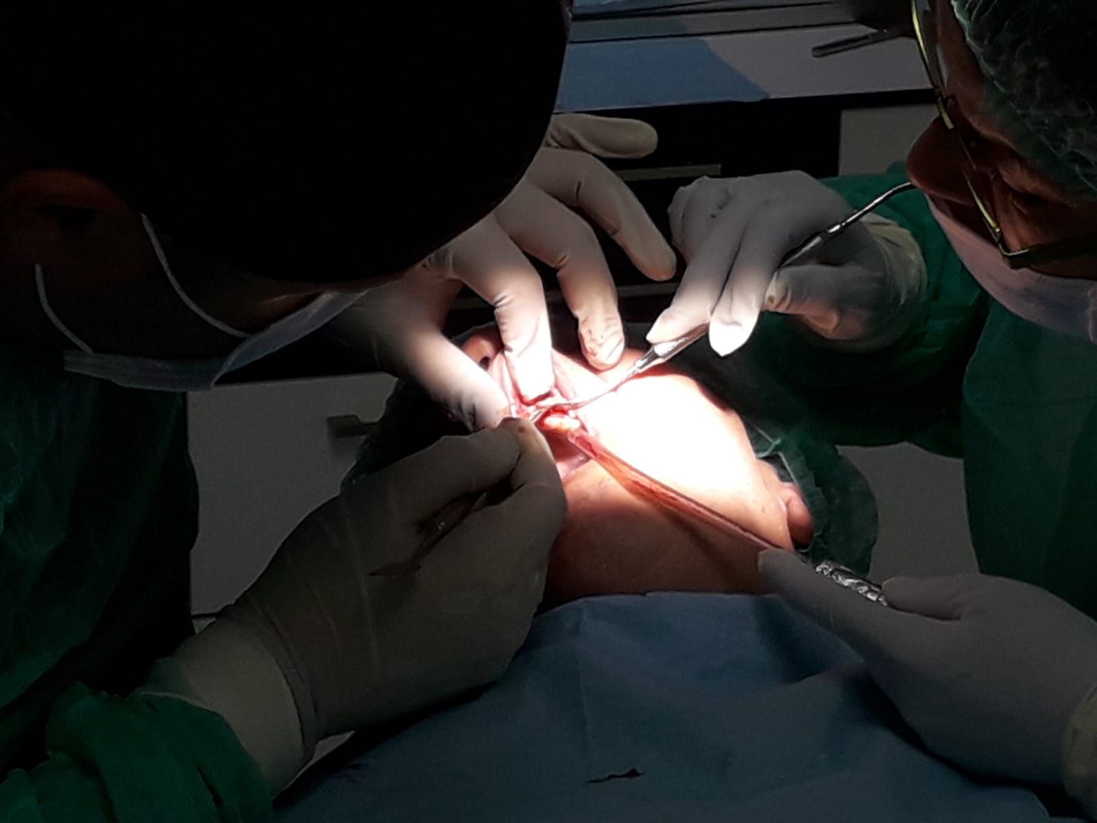 Fotografia cirugia de implantes, Clinica Dental Urbina