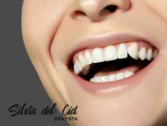 Noticias Salud | Odontología Estética en Torremolinos