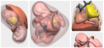 Noticias Infantil | Lesión pulmonar