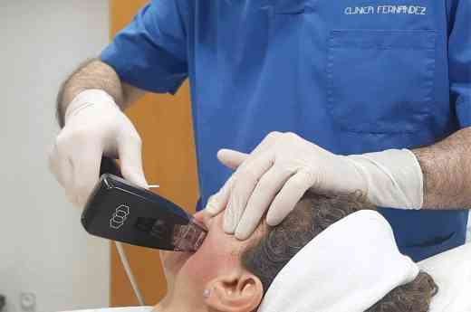 Clínica Fernández incorpora el tratamiento Morpheus8: tecnología mínimamente invasiva para rejuvenecimiento facial y corporal