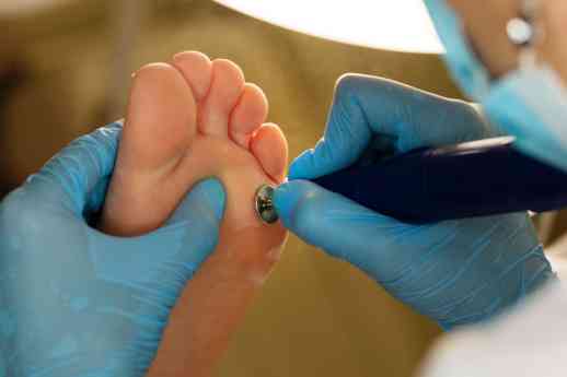 Los podólogos de la Unidad del Pie de Policlínica Gipuzkoa y Podoactiva ofrecen consejos para tratar el aumento de infecciones por hongos en los pies durante el verano