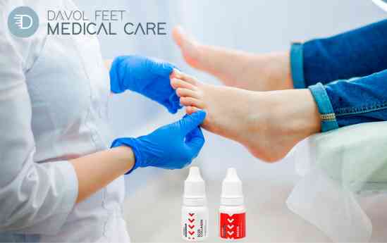 Hongos en las uñas: señales silenciosas que no se deben ignorar, por DAVOL FEET MEDICAL CARE
