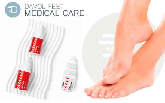 Soluciones especializadas en tratamientos de hongos en las uñas por Davol Feet Medical Care
