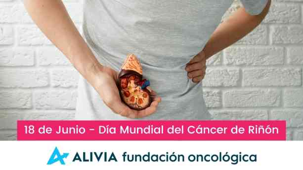 Solo 2 de 8 tratamientos recomendados para cáncer de riñón se financian en España