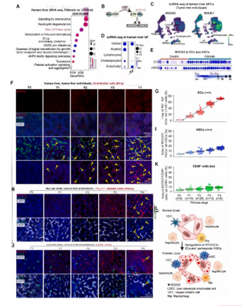 Un estudio publicado en Cell identifica ROCK2 como nueva diana terapéutica para la fibrosis hepática con el apoyo de Cloud-Clone